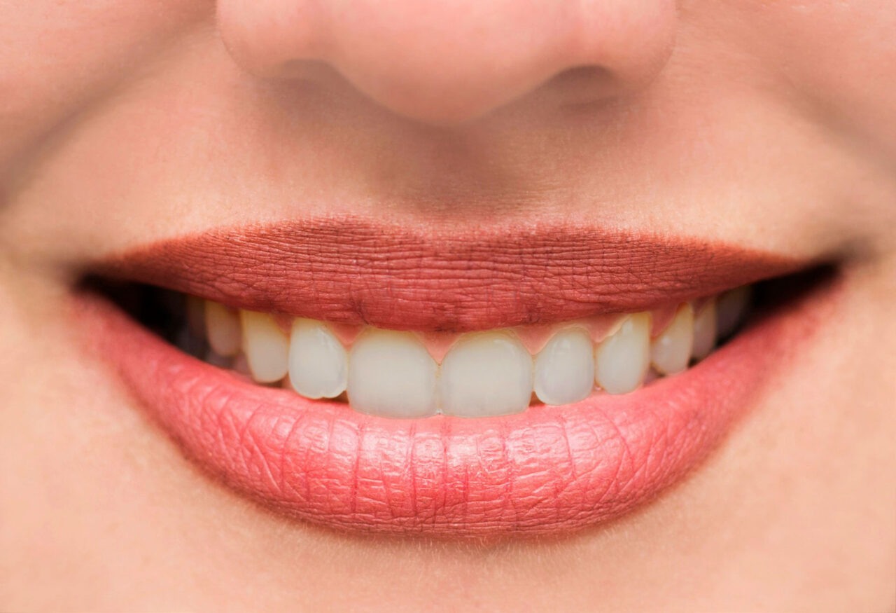 woman-s-lips-and-teeth-smile-close-up3 woman-s-lips-and-teeth-smile-close-up3